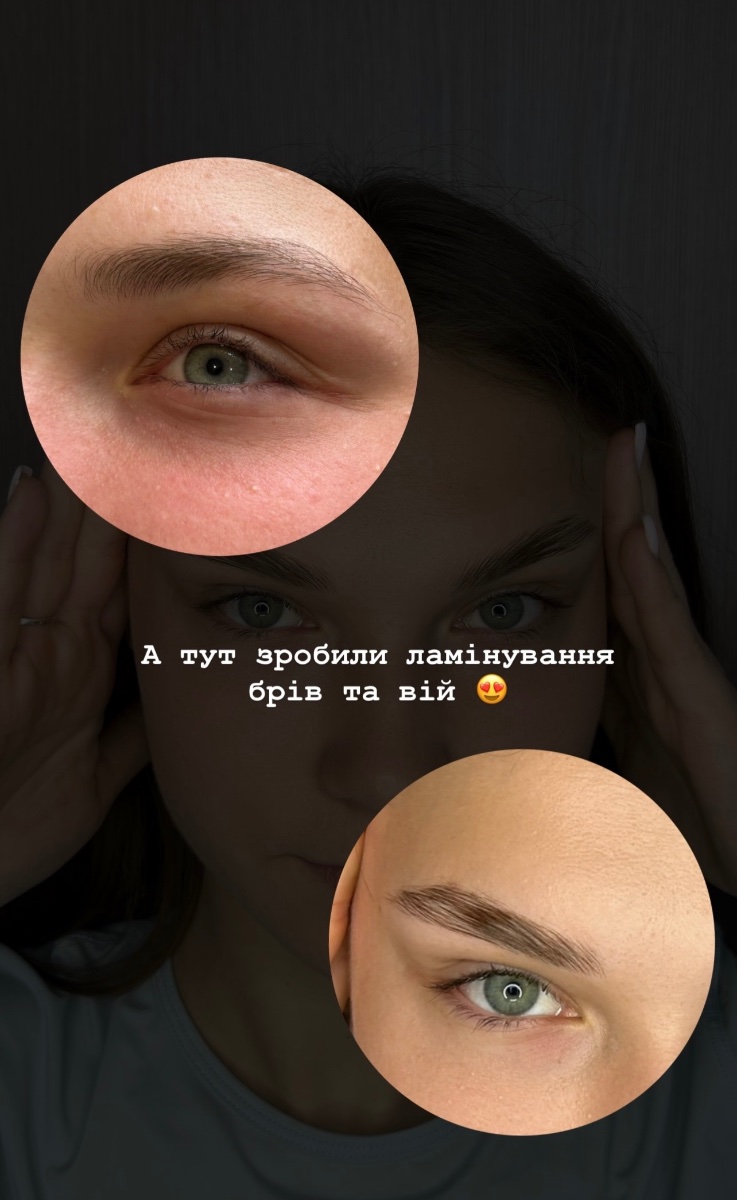 Нигора Корецкая — робота 5, Запоріжжя