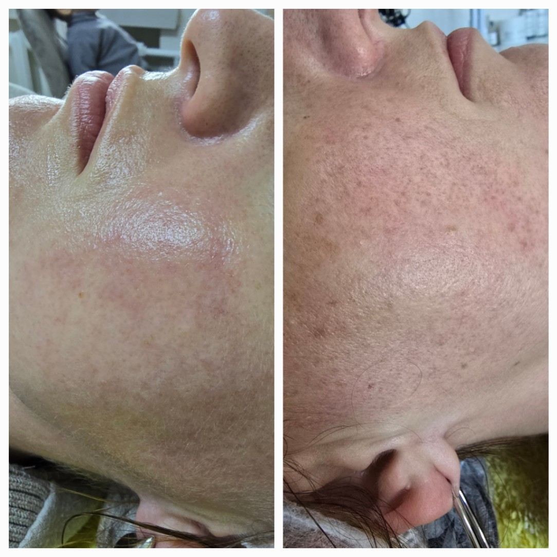 Tetiana Tsipan — роботи, Рівне