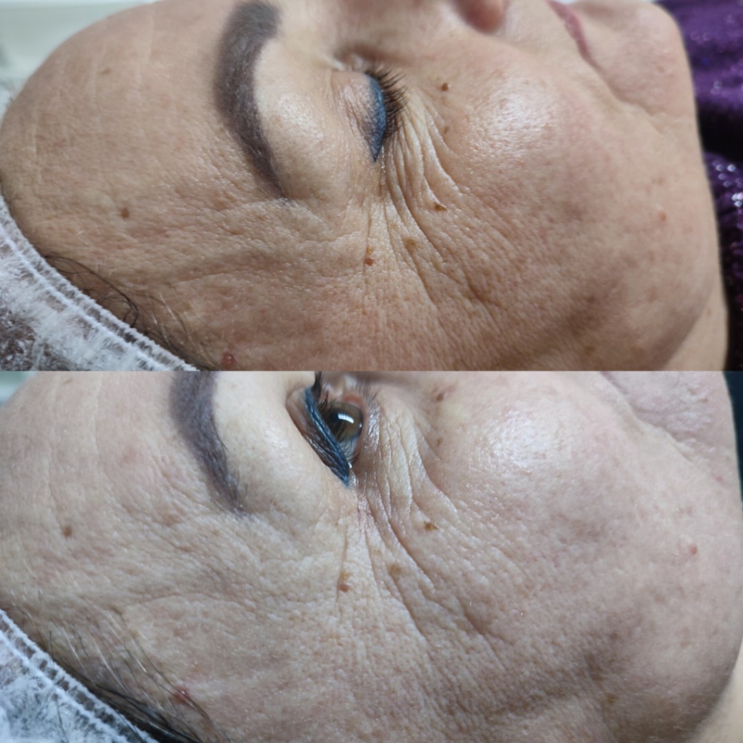 Tetiana Tsipan — робота 9, Рівне